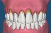 Chicago Periodontics