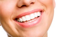 Chicago Teeth Whitening