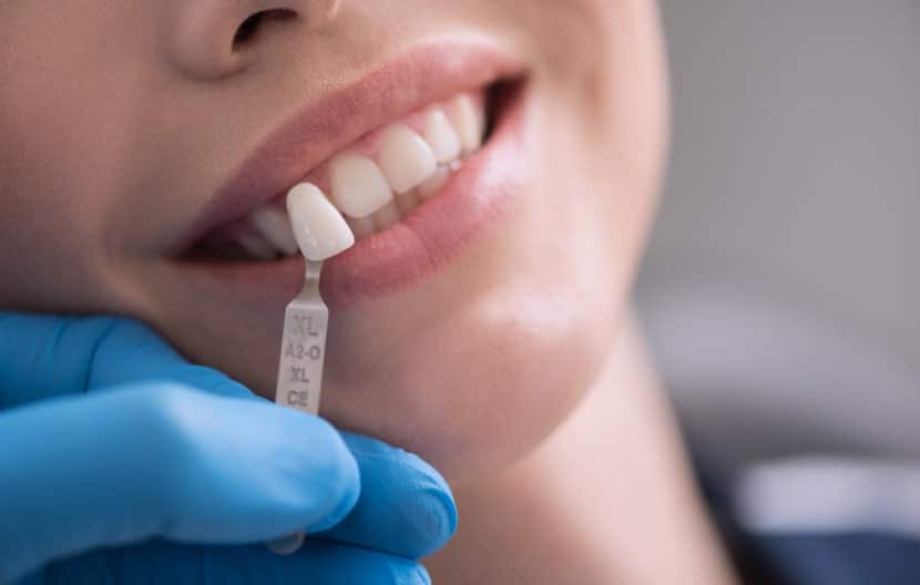 Dental Extraction In Chicago