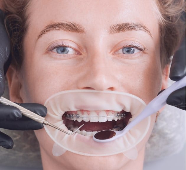 Orthodontic Treatment In Chicago, IL