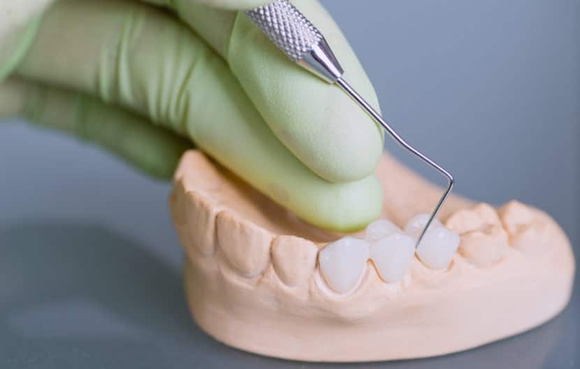 Top-Quality Dental Treatments