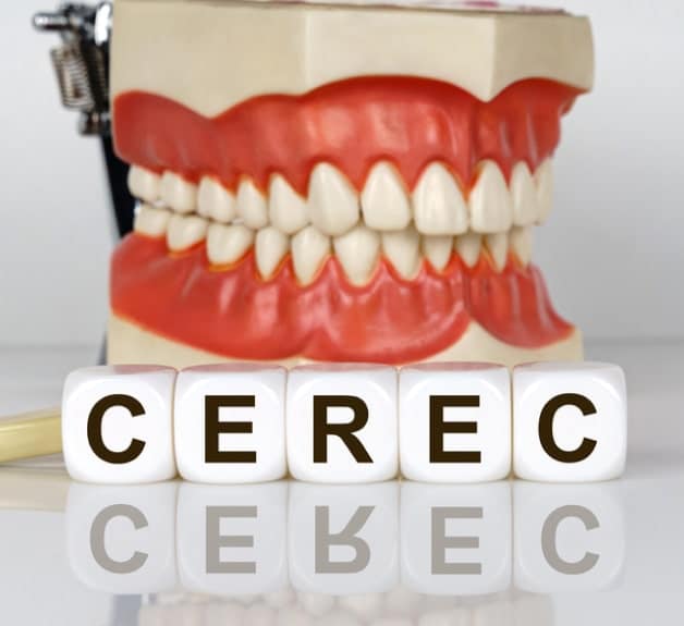 CEREC Technology In Chicago